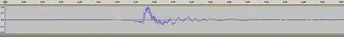 image of waveform shows steady line, then sudden disruption, settling down to steady line
