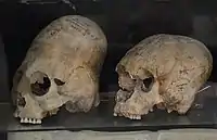 Elongated skulls from Afrasiab, Samarkand, Sogdia, 600–800 CE