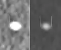 Measurement of a 5.6&nbsp;mm large kidney stone in soft tissue versus skeletal CT window.
